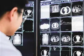 一次平扫CT 筛查多种癌症（大健康观察）图片