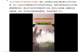 女子咳嗽半月 气管发现8cm蚂蟥：或饮用生水所致图片