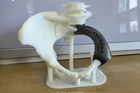 贵州首例！贵医附院成功实施高难度半骨盆+半骶切除联合3D打印肿瘤假体置换手术图片