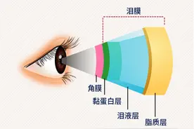 眼睛 “迎风流泪”？千万别把它当小问题！图片