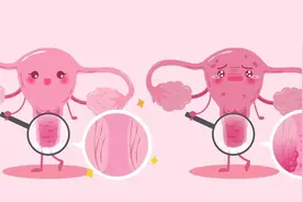 宫颈感染HPV，这份中医治疗攻略分享给您→图片