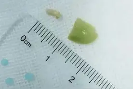 2岁女童突然呼吸困难！又是它图片