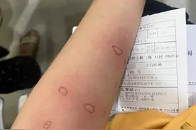成都回应网友圆柏花粉过敏：圆柏栽植很少，绿化规划已不再使用图片