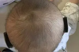 男子称花十多万元生试管婴儿，体检发现儿子双耳失聪无奈置入耳蜗；卫生监督局：未发现涉事门诊部存在问题图片