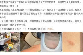 别再抹牙膏、酱油、白酒了!烫伤急救“五字诀”了解一下→图片