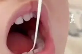 服用健敏思无敏液体钙一周后，眼周现红斑，品牌回应：仅不含8大敏感原。图片