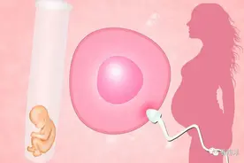 在新加坡接受试管婴儿治疗，该如何选择卵子捐赠？图片