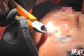 男子夜钓甩钩，竟然钓住了自己图片