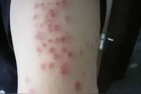 “吸血鬼”防不胜防！这波危机已经离我们越来越近！图片