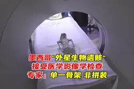 墨西哥疑似“外星生物遗骸”接受医学影像学检查图片