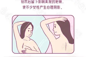 发现乳腺疾病不要慌！这种方法让手术切口“隐身”，让疤痕“无形”图片