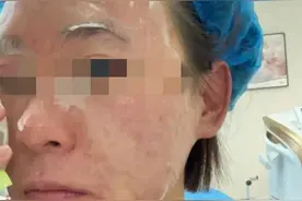 打针后，突发休克！要警惕！图片
