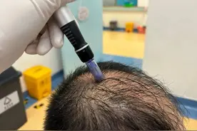 打好发量保卫战，拒绝“秃”然“绝顶”！图片