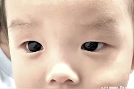 泰国半岁男婴用药治疗新冠，深褐眼睛竟然一夜之间变成亮蓝色图片