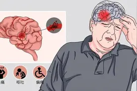 脑卒中该如何预防和治疗？丨健康智慧屋图片