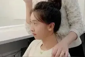 屡上热搜！明星女儿也中招！这个小习惯，让很多人“失去下巴”……医生：门诊中非常多见！图片