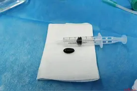 2岁娃娃吃释迦果遭果核堵住气管，医生“拆弹”救命，提醒：春节看护好孩子进食图片