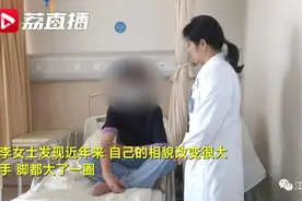 变丑可能真是一种病！女子相貌突然异变，竟是这个病在作怪图片