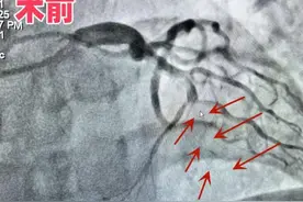 误以为胃痛，结果却查出……建德一男子险些丢了性命！图片