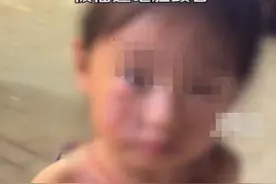 上海一女孩在水果店被榴莲砸伤脸，母亲称店方拒付后期治疗费，店家：在协商，交接时两人都没拿好图片