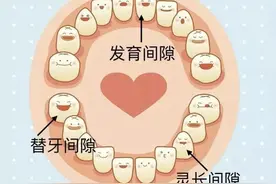 牙齿间隙，要不要重视？图片