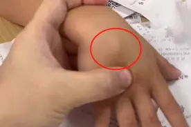 担心的事情发生了！福州一小学生，拍“烟卡”进了医院！图片