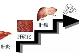 不穿刺 弹一弹就出结果 驻马店广济心血管病医院肝硬度检查有新招图片