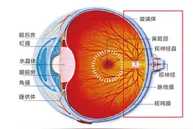 爱尔科普：视物扭曲了？小心黄斑病变图片