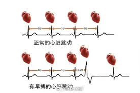 为什么心脏会突感咯噔一下？感觉心脏要跳出来了可能是这个原因图片