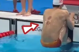 多图欣赏！拔火罐、肚脐贴……神秘“东方力量”频频亮相巴黎奥运赛场图片