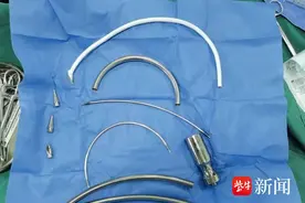 血管太细透析不充分，人工血管架起血液透析“新管道”图片