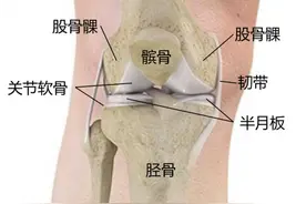 膝关节为何会损伤？换了人工关节啥感觉？一文了解→图片