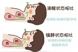 麻醉前为什么要禁食水？图片