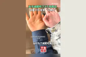 山东女子减肥吃南瓜变身“小黄人”图片
