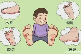 【杨柳血管智汇】血管外科：糖尿病患者如何自己检查双脚？图片