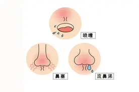 鼻子为何老是堵？或许是因为……图片