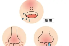 鼻子为何老是堵？或许是因为……图片