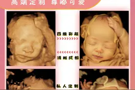 一张四维彩超图就能预测胎儿长相？专家：娱乐性大于准确性图片