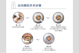 高龄老人，还能做白内障手术吗？图片