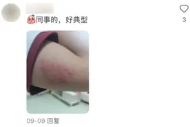 一旦感染终身携带，痛起来如刀割、似火烧！深圳疾控提醒图片