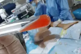 致死率超95%！14岁少年野泳后感染“食脑虫”，医生提醒图片