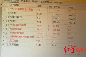 男子骑动感单车过猛确诊横纹肌溶解，医生：运动后出现这些症状应就医→图片