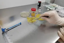 男子头皮撕脱伤致颅骨外露，富血小板血浆技术助其快速“自愈”免去植皮图片