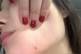 女子称在上海INS新乐园被人用烟头烫脸，市监部门介入图片
