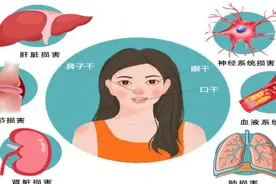 【健康科普】认识干燥综合征图片