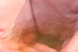 气温变化频繁 球形棕囊藻反复出现图片