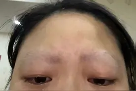 一女子被家养鹦鹉啄光眉毛，当事人：又快又准，还以为在按摩图片