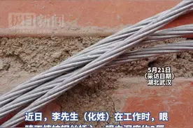 惊险！钢丝扎进男子眼球，医生10分钟紧急取出图片