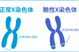孩子快4岁了还不会说话，诊断为脆性X综合征……专家提醒，这些人群需筛查图片