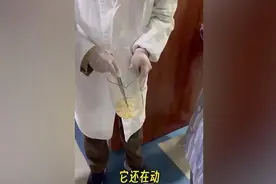 女子肛门处刺痒难忍，排出10米长寄生虫图片